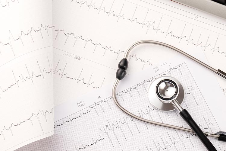 心臓・不整脈・動脈硬化