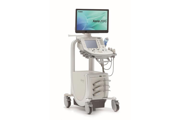 超音波検査（エコー）